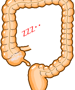 私の便秘はどのタイプ？